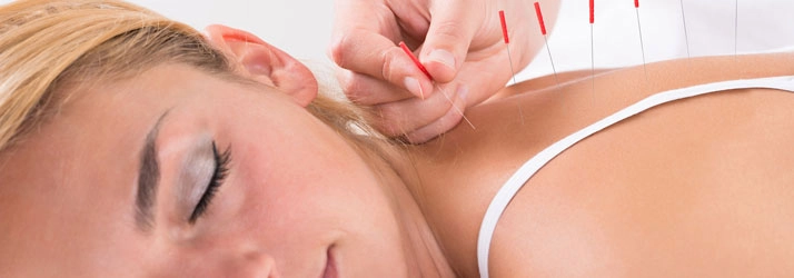 Chiropractic Jupiter FL Acupuncture